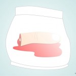 670px-Retrieve-the-severed-finger-Step-4