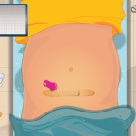 acoU3