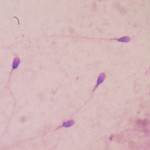Sperm_stained