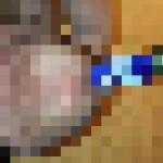 Urètre_censored