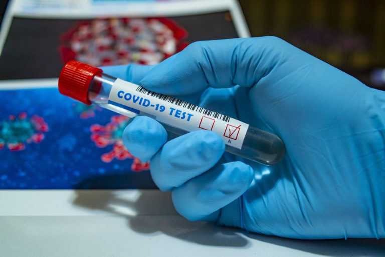Tests Covid-19 : pas fiables chez les fachos